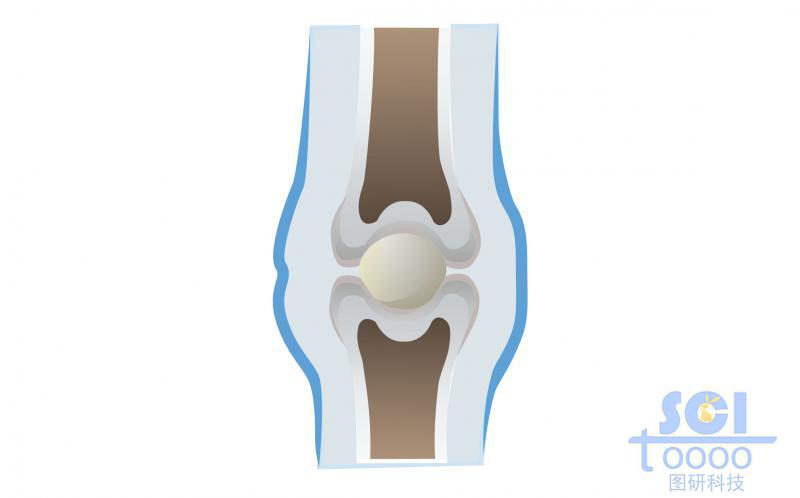 膝关节及软骨